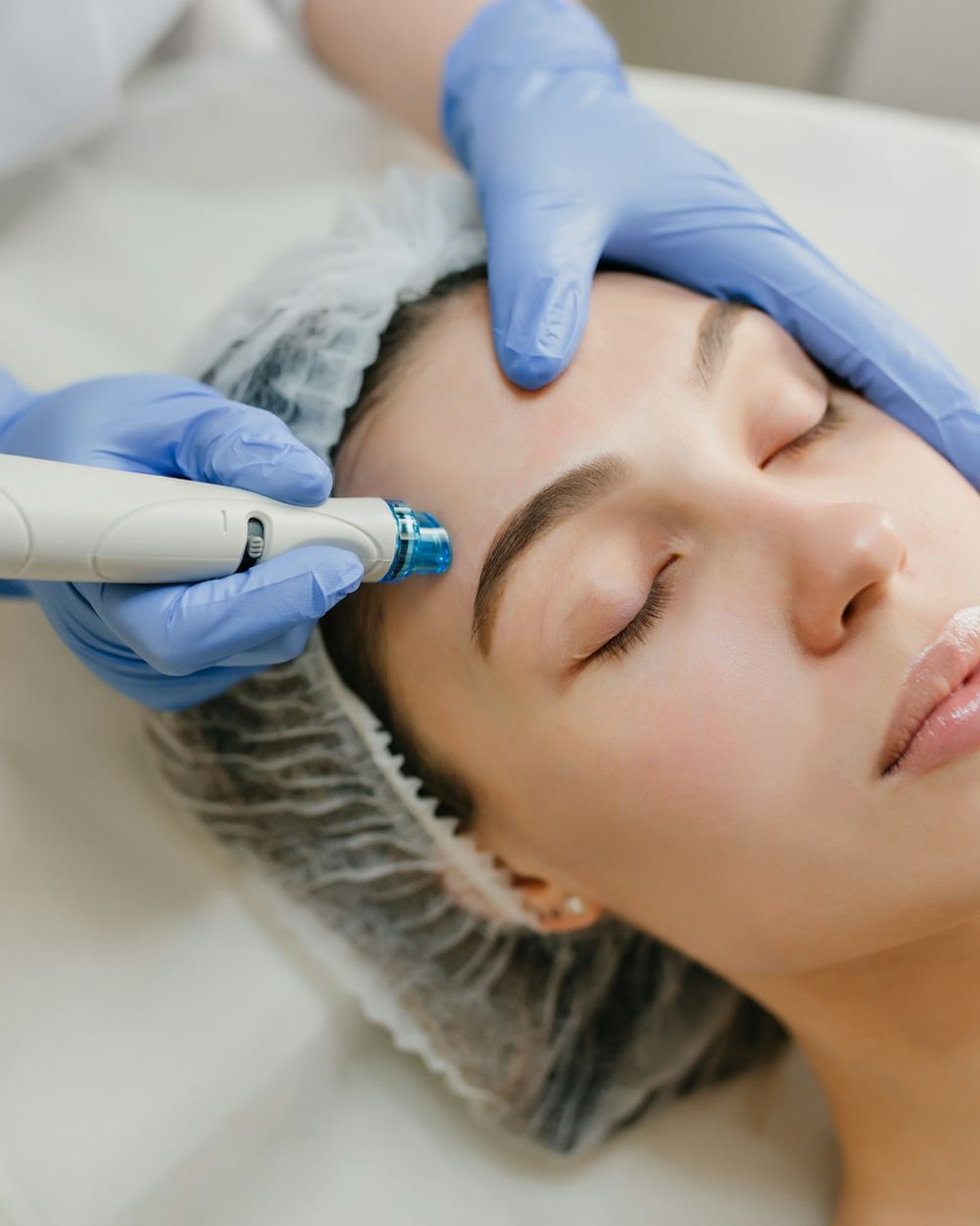 Gloved hands guiding a handheld treatment device across a client’s forehead